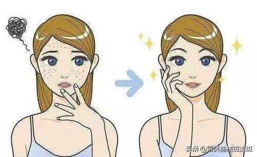 最简单的祛斑方法（简单有效的祛斑方法）
