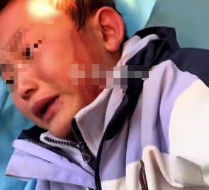 曲靖会泽县学生被老师打破头事件引发社会关注